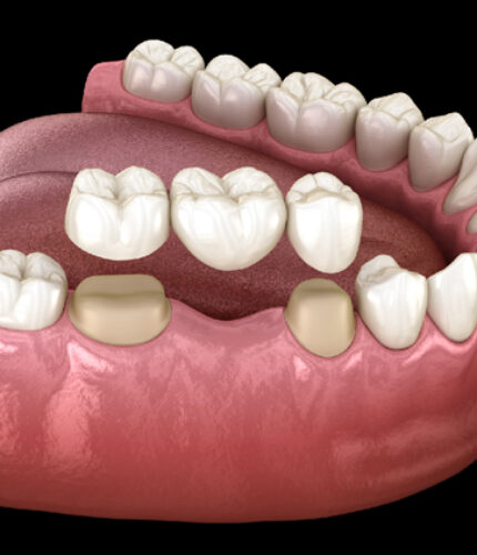 Treatment - 2 Green Dental Boutique