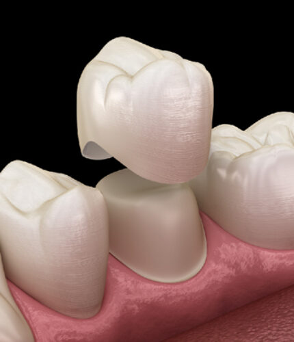 Treatment - 2 Green Dental Boutique