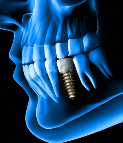 Treatment - 2 Green Dental Boutique